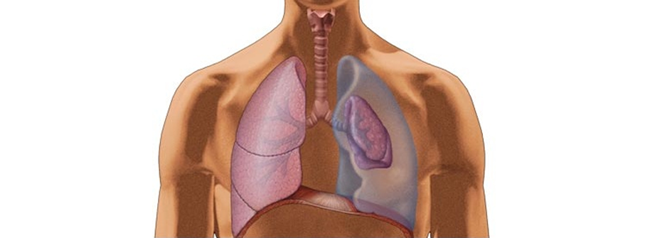 Spontaneous Pneumothorax: Causes, Symptoms and Treatment.